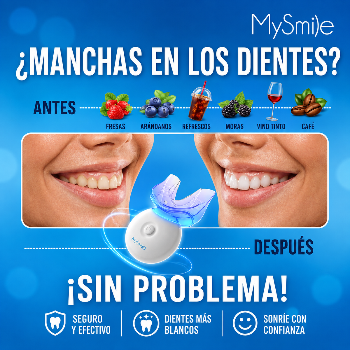 KIT DE BLANQUEAMIENTO DENTAL MYSMILE