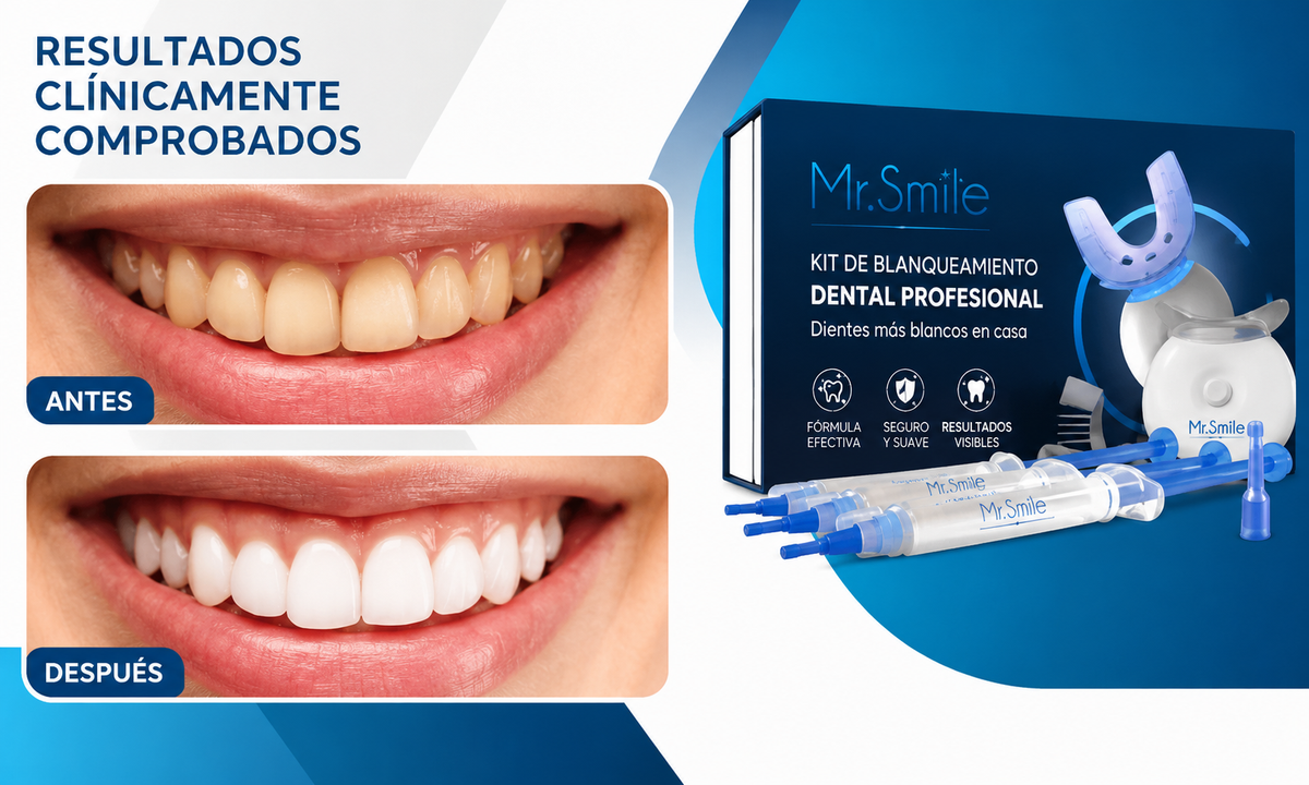 KIT DE BLANQUEAMIENTO DENTAL MYSMILE